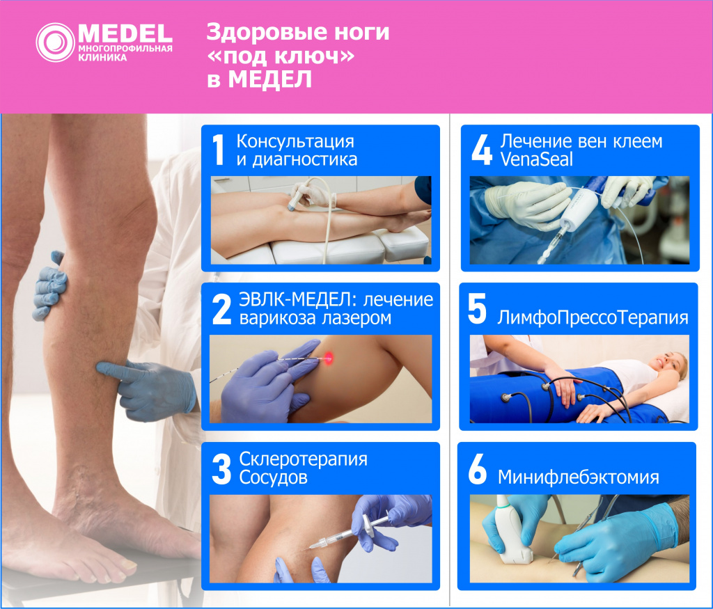 Флебология Флебология